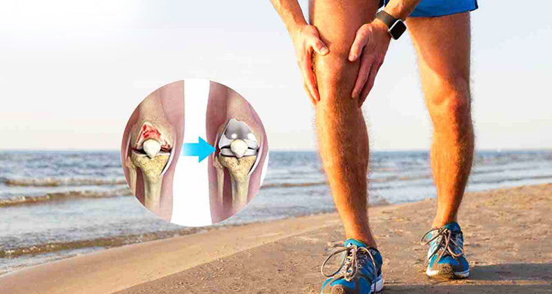 Expertise in  Joint Replacement